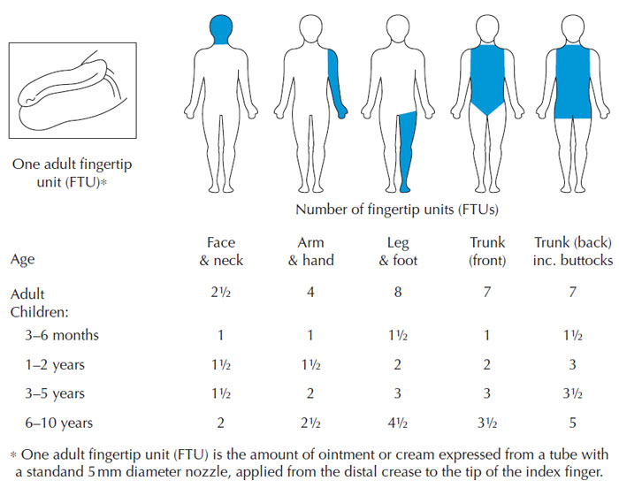 Figure 9.11 Diagram of FTU and chart with FTUs for treating adults and children.