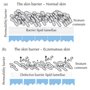 Figure 9.5 (a) Normal and (b) eczematous skin barrier. (Source: Cork, 1999.)