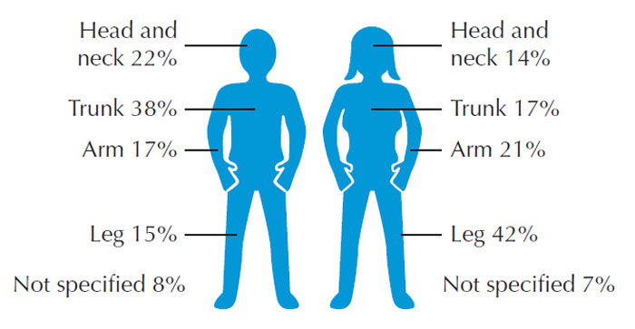 Figure 11.7 Distribution of melanoma on parts of the body by sex. (Source: Cancer Research UK, 2009a.)