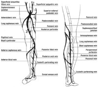 Fig. 8.2. Simplified diagram of major veins in the legs. The superficial veins are shown in solid black. (Reprinted with permission from Goldman MP (1991) Sclerotherapy: Treatment of varicose and telangiectatic leg veins. Mosby, St. Louis.)