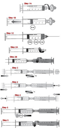 Fig. 8.9. a Left: Omnifix syringe; right: (shaded) Injekt syringe. Preparation I: sterile filtration of air. The Sterifix 0.2-μm sterile filter is first screwed onto the threepart, 10-ml Omnifix syringe for sterile filtration of ambient air (step 1A), and an exact amount of 8 ml ambient air is drawn up in accordance with the graduation of the syringe barrel (step 1B). A hygienically proper procedure is mandatory. Preparation II: drawing up of Aethoxysklerol. Afterward, the Sterifix 0.2-μm sterile filter is removed and 1 ampoule of Aethoxysklerol 3% is drawn up completely (2 ml), as usual, into the same syringe using a sterile disposable cannula (step 1C). The inadvertent drawing up of additional sterile air is to be avoided. Preparation III: assembling the dual syringe system. The Combidyn adapter is first firmly connected to the filled Omnifix syringe (step 2A) then to the Injekt syringe (step 2B) by rotation in order to assemble the dual syringe system. (Personal communication from J-C.G.R.Wollmann M.D.).b Left: Omnifix syringe; right: (shaded) Injekt syringe. Foam generation I: mixing phase. The foam generation is performed in two phases: In the first mixing phase,Aethoxysklerol 3% and sterile air are mixed to obtain a dispersion. This is achieved by moving the plunger of the filled Omnifix syringe five times forward and backward with a short, firm, thumb pressure of one hand (step 3). The thumb of the other hand holds the plunger of the (shaded) Injekt syringe so that pumping must be done against a resistance, and the Omnifix plunger returns to its starting position by passive pressure. The (shaded) Injekt syringe is held a bit lower. Foam generation II: homogenization phase. The homogenization phase follows immediately: The plunger of the Omnifix syringe is pressed quickly while the plunger of the (shaded) Injekt syringe is not fixed but can move freely so that no resistance is generated at that time. This forward and backward movement is followed by an opposite backward movement by exerting pressure on the plunger of the (shaded) Injekt syringe in the same manner. A total of seven quick forward and backward movements are performed (step 4). The plunger of the Omnifix syringe is drawn back to the 10-ml mark to make sure that no excess pressure remains in the double- syringe system (DSS) (step 5). The adapter and the (shaded) Injekt syringe are eventually removed and discarded. The mixing phase and the homogenization phase will take a total of 4–5 s for experienced users. A sterile, very fine, homogenous foam is obtained, which remains stable for a couple of minutes. The procedure ensures a high degree of reproducibility if performed correctly. A common injection cannula is then attached or screwed on to the Omnifix syringe, which now contains 10 ml Aethoxysklerol foam for immediate further use. (Personal communication from J-C.G.R.Wollmann M.D.)