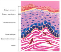 Epidermal layers and papillary dermis.
